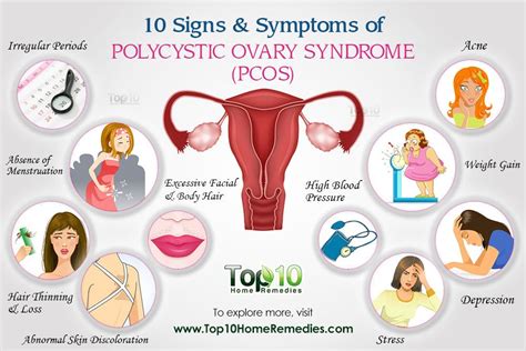 polycystic ovaries tagalog|Polycystic Ovary Syndrome (PCOS): Mga Sintomas, Mga sanhi .